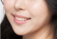 防止妊娠纹用什么牌子的产品好