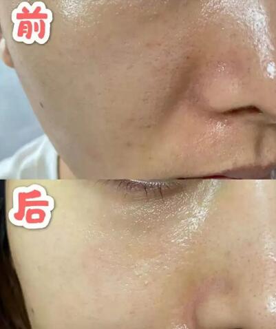 白芷与什么搭配祛斑效果最好(白芷粉搭配什么能祛斑美白)