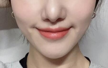 美容仪器小气泡多少钱(美容仪器小气泡的清洗方法)