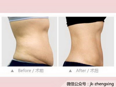 快速瘦腰瘦肚子的方法「快速瘦腰瘦肚子的运动」