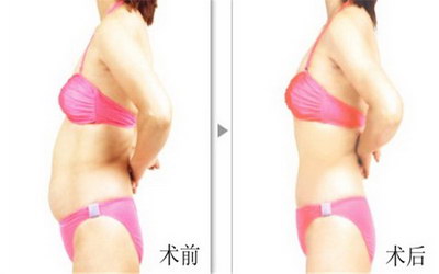 中年男如何减肚子的肉「中年男如何减肚子」