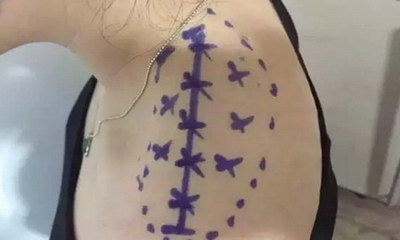后背厚怎么减 这六招让你快速瘦肩(后背厚怎么减这六招让你快速瘦肩)