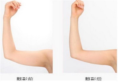 动感单车手臂动作(合理的调整手把高度)