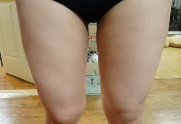大腿肌肉块怎么消除(大腿肌肉怎么消除)