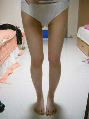 小腿肌肉劳损一般要多久恢复