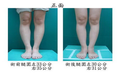 快速瘦大腿和臀部15天孕妇能做吗(身体状况决定可行性)