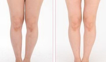 慢跑一个月瘦腿明显吗?
