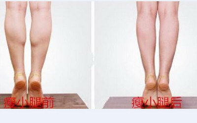 大腿溶脂效果好吗(大腿溶脂针瘦腿效果图)