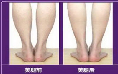 人瘦腿粗什么原因(上身瘦腿粗是什么原因引起的)