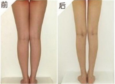 如何减掉大腿和臀部的赘肉(如何减掉臀部和大腿上的肉)