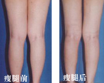 如何减去小腿肥肉_小腿纹身纹什么寓意好