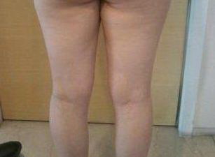 大腿内侧赘肉怎么穿搭(怎么减大腿根内侧的赘肉)