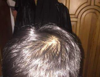 男生一般在什么年纪脱发严重(男生纹眉一般都纹什么眉)