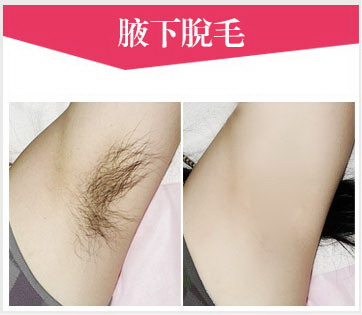 腋下毛发太多怎么办(腋下毛发过多怎么办？)