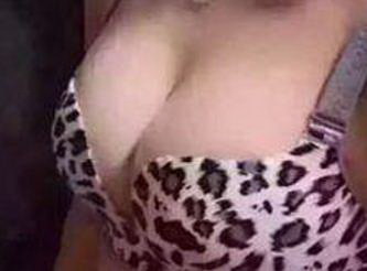 矫正牙效果怎么样(乳房下垂矫正效果怎么样)