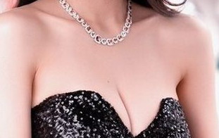 做巨乳缩小失败修复需要多少钱？