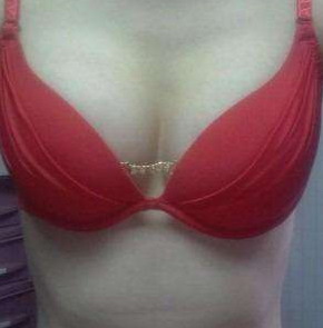 3d聚左旋乳酸是什么(3D聚左旋乳酸是什么)