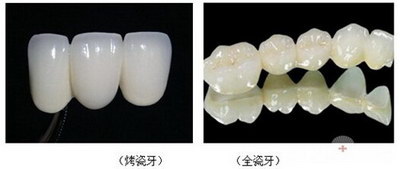 牙齿整形有包括牙齿缺损补救吗？