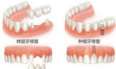 牙黄用什么刷牙能白(牙黄用什么刷牙)