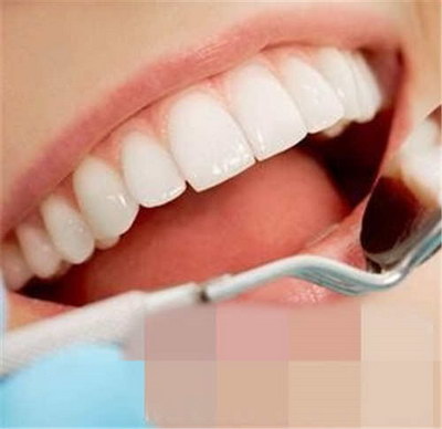牙齿矫正的适宜年龄,您的孩子赶上了吗？