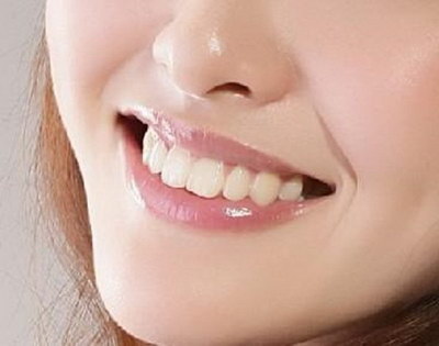 多颗牙齿缺失的后果