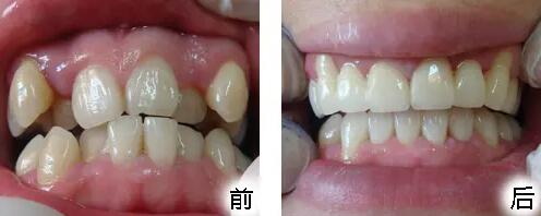 西安烤瓷牙整形医生排行