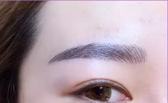 我的眼袋很重怎么办_20岁眼袋很重怎么办