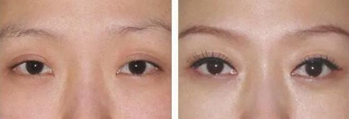如何快速清除眼袋(如何清除眼袋快速)
