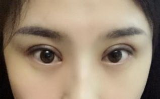 如何才能让眼袋退祛除_怎么去眼袋皱纹最快最有效