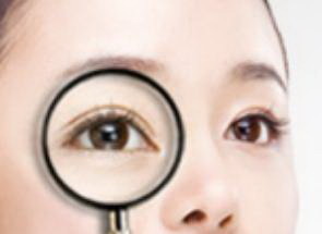 怎么去除眼角下皱纹_如何去除眼角纹的