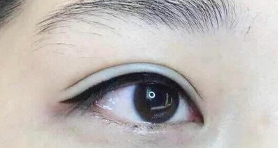 为什么左眼眼皮有点下垂_为什么眼皮容易松弛