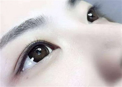 年纪轻轻怎么会有眼袋(年纪轻轻有眼袋怎么搞)