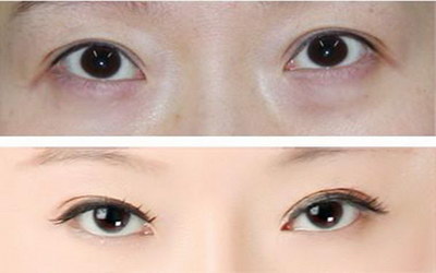 眼部代谢不好是什么原因(眼部代谢不好的原因)