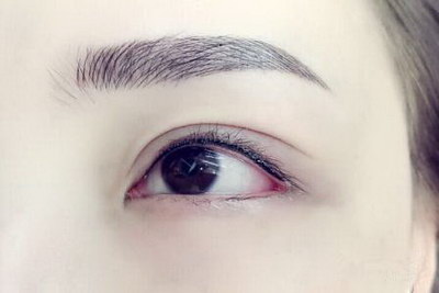 眼皮下垂提拉手法(提拉眼皮下垂贴)