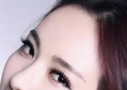 做了双眼皮多久可以吃韭菜(做完双眼皮多久可以吃韭菜)