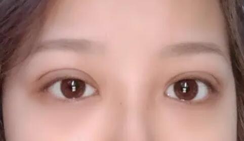 黑眼圈重是什么原因怎么调理(5岁小孩子黑眼圈重是什么原因造成的)
