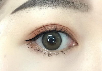做完双眼皮手术适合吃什么(双眼皮手术后适合吃什么？)