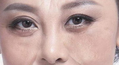 成都双眼皮哪里做的最好(成都哪里双眼皮做的最好)