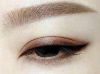 双眼皮埋线的线会被眼睛吸收吗(什么是双眼皮埋线？)