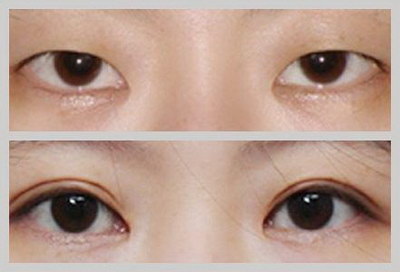 嘴唇老是干裂起皮是怎么回事「眼皮肿嘴唇干裂是怎么回事」