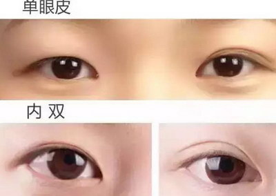 淡化泪沟和眼袋(如何淡化眼袋泪沟)
