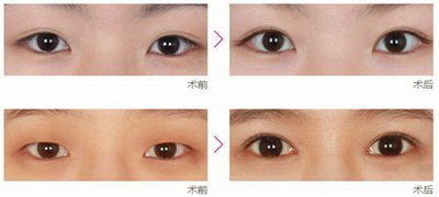 纹下眼线是什么意思_纹眼线好学吗