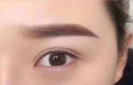 近视眼激光手术多久能看手机(近视眼激光手术多久能喝酒)