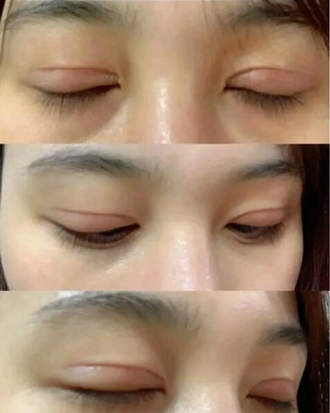 眼霜去黑眼圈眼袋哪个牌子的效果好【眼霜去黑眼圈眼袋哪个牌子效果好】
