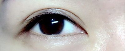 眼角色斑如何去除(如何快速去除眼角色斑)