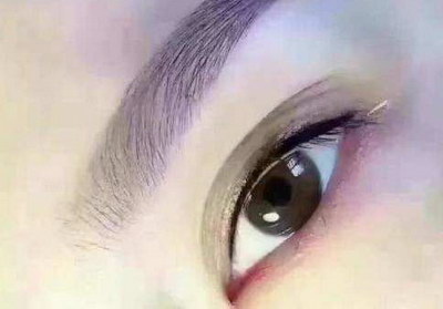 做完双眼皮眼睛总是雾蒙蒙(做双眼皮的原理)