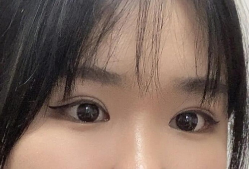 上海双眼皮哪家强(上海双眼皮哪家做的最好)