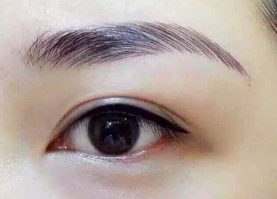 做完双眼皮打几天消炎针比较好(做完双眼皮大概多打几天消炎针比较好)