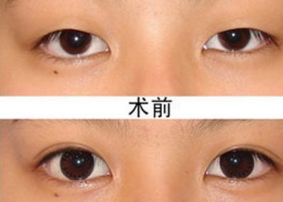 为什么睡多了眼袋更重_眼袋纹与阴骘纹