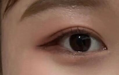 眼部填脂肪要填多少_眼部松弛是什么样子